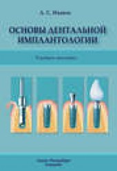 Книга "Основы дентальной имплантологии, автор Александр Иванов - BooksFinder.ru